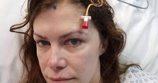 'I'm lucky I'm here to tell the tale' Routine eye test revealed woman's  potentially fatal brain condition