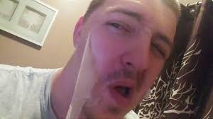 More images for sunburn peeling face » Sunburn Skin Peeling Youtube