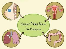 Kanker payudara adalah kanker pada jaringan payudara. Jawapan Doktor Bagi 17 Soalan Lazim Tentang Kanser Serviks Erufu Care