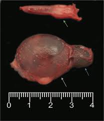 Sometimes, fat deposits form in the thyroid tissue. Non Functional Thyroid Cystadenoma In Three Boxer Dogs Bmc Veterinary Research Full Text