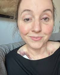 Fundraiser by Lindsay Brown : Donate to Linds's Cancer Treatment