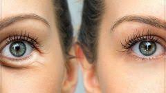Goz Alti Torbalari Nasil Gecer Eye Anti Aging Skin Firming Crows Feet