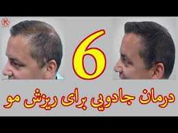 ۶ درمان جادویی برای ریزش مو Youtube Cardio Workout At Home At Home Workouts Beauty