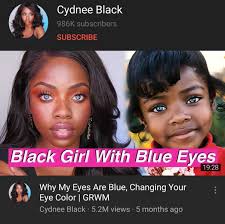 When someone's eyes have any form of multicoloration, they probably have heterochromia iridum or heterochromia iridis. How Can A Child Have Two Different Colored Eyes Quora