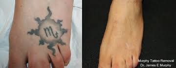 Looking for the best tattoo shops in reno north? Nevada Tattoo Removal At Murphy Plastic Surgery Tattoo Piercing Shop Reno Nevada Facebook 91 Photos