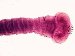 Image result for Beef Tapeworm