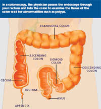Discover 10 common colon cancer symptoms at 10faq health and stay better informed to make healthy living decisions. Asge Understanding Minor Rectal Bleeding