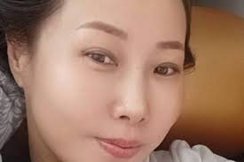 Fundraiser by Matt Widder : OkYoung Needs Your Support for Surgery