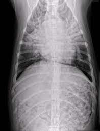 A white spot amidst the normal black lungs can therefore be a cancer, infection. Pneumonia Management In Dogs And Cats Veterinary Partner Vin