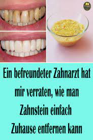 Zahnstein sind feste beläge auf dem zahn. Ein Befreundeter Zahnarzt Hat Mir Verraten Wie Man Zahnstein Einfach Zuhause Entfernen Kann Zahnstein Entfernen Zahnarzt Zahnstein