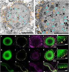 Check spelling or type a new query. Lewy Pathology In Parkinson S Disease Consists Of A Crowded Organellar Membranous Medley Biorxiv