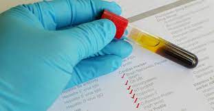 We did not find results for: Proteina C Reactiva Ce Este Si Ce Se Intampla Atunci Cand Valorile Sale Cresc