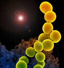 But because it takes about 48 hours for the bacteria to grow, newer tests that can detect staph dna in a matter of hours are now becoming more widely available. New Drug Effective Against Mrsa In Mice National Institutes Of Health Nih