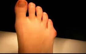 Blackmer Foot & Ankle