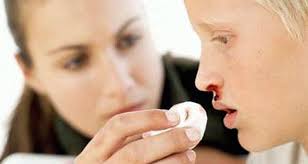 Sel darah putih juga dikenal sebagai leukosit serta sel darah putih. 5 Akibat Kekurangan Sel Darah Putih