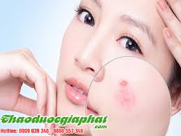 Mua Bán Lá Đu Đủ Đực Tại Quận Tân Phú Giúp Loại Bỏ Mụn Trứng Cá Rất