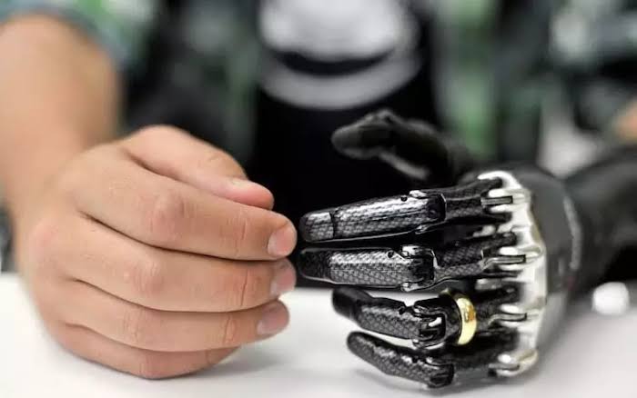 Como Funcionam as Próteses Biônicas: Conheça as Próteses do Futuro – Excelência em Próteses Biônicas e Órteses | Bionicenter