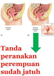Selain menampilkan keindahan alam dan hijaunya perbukitan luas. Tanda Peranakan Jatuh Masalah Jamu Susuk Dara Sitie Facebook