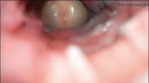 Vagin, santé du vagin : Video Rare D Une Sodomie Et D Une Ejaculation Anale Filmee De L Interieur