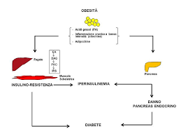 Eccesso di cibo e mancanza di. File Sindrome Metabolica1 Jpg Wikimedia Commons