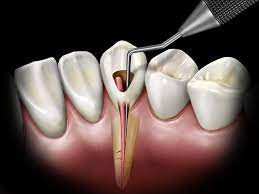 Aegis Media On Twitter Dental Videos Dental Dental Crowns