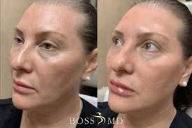 Boss MD Plastic Surgery
