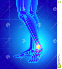 L'articulation de la cheville est raide, mais la douleur est d'intensité variable. Douleur Et Gonflement Sur L Interieur De La Cheville Douleur D Un Pied Illustration De Vecteur Illustration Du Douleur Cheville 73206902