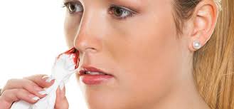 Resultado de imagen para nasal blood