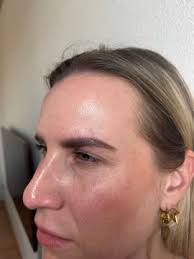 Botox Oud-Beijerland, vergelijk klinieken