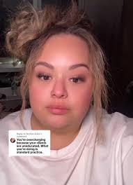 Rachel Welsh Bird Botched