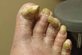 Pin On Health