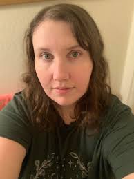 Hair loss during first trimester of pregnancy?