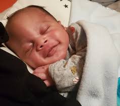 Born With Craniosynostosis, Toddler Thrives After Brain Surgery