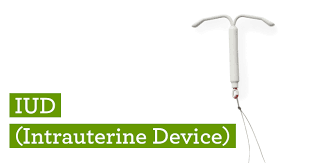 If you go for paragard, the average price of iud ranges from $40 to $77. Iud Birth Control Method