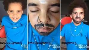 Washington us, january 21 (ani): Omg See What Happens To Drake And Chris Brown Face After Surgery Houseoftobtos