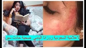 .هذا الرابط وإنشاء حسابك كما سنبين لكم بالصور ، في البداية ( قم بالنقر هنا ) • ملاحظه اذا كان لديك حساب قديم للاسف لم يعد يعمل حيث تم تحديث الموقع من قبل الشركة ويجب. Ø§Ù„Ø¥Ø¹Ù„Ø§Ù…ÙŠØ© Ø§Ù„Ø³Ø¹ÙˆØ¯ÙŠØ© Ø±ÙˆØ²Ø§Ù†Ø§ Ø§Ù„ÙŠØ§Ù…ÙŠ Ø¶Ø­ÙŠØ© Ø­Ø§Ø¯Ø« Ø³ÙŠØ± ØµÙˆØ± ØªÙƒØ´Ù Ø­Ø¬Ù… Ø§Ù„Ø¥ØµØ§Ø¨Ø§Øª Youtube