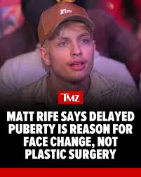 MattRife didn't go under the knife ... or so he claims -- saying despite  people thinking otherwise, his drastic face change is just the result of  delayed puberty.