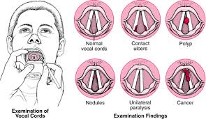 Overview Of Laryngeal Disorders Ear Nose And Throat Disorders Voice Therapy Speech Therapy Speech Language Pathology