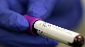 Coronavirus Test Quest Diagnostics Says Covid 19 Testing Demands Reaching Unprecedented Levels Amid Reports Of Backlog Abc7 San Francisco