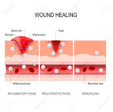 Wound Healing Process Diagram Wiring Diagram Term