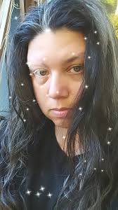 Woke up with a bad migraine and itching head hurts nauseated