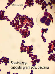 Find out information about sarcinae. Rich Davis Phd D Abmm Mls On Twitter Microrounds Day 404 Hip To Be Square A Rare In The Clinical Lab Bacteria With An Amazing Gram Stain Sarcina Spp Divide Along 3