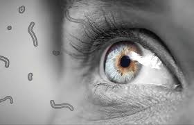 What are Eye Floaters? Understanding ...