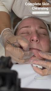 A complete skin cleansing is a professional skincare procedure designed to  deeply purify the skin, removing impurities, blackheads, dead cells, and  excess oil. It helps to renew the skin, improve ...