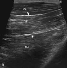 Whether it's to pass that big test, qualify for that big promotion or even master that cooking technique; Hip And Thigh Ultrasound Clinical Gate