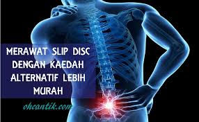 Slip disc dalam bahasa medic dipanggil hernia, ia bermula dengan degenerative disc disease, term disease itu sendiri dah melambangkan sesuatu yang boleh merebak kan…. Rawatan Slip Disc Alternatif Dengan Kos Lebih Murah Ohcantik Com