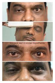Image result for Ice Pack Test