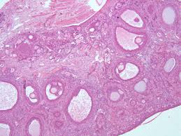 Tertiary follicle or graafian follicle. Ovary From Cat 40 X Anatomicum Com