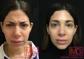 Some reports suggest that vaping is twice as effective as other nicotine i had tissue (gum) surgeries here & the results were great. Vaping Electronic Cigarettes And Regular Cigarettes What Are The Differences In Using Them Before Surgery