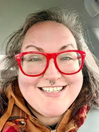 Had my attachments off today and a zoom whitening session to try and speed  up the whitening so I can get my bonding done before my wedding in 4 weeks!  August 2023-March